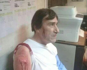 El chofer apuñalado (Foto: Twitter @SicoraCTA)