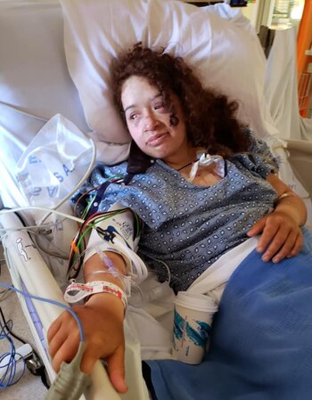 A pesar del terrible accidente,