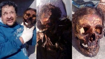 Un hombre se sacó una