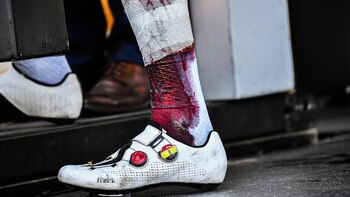 El tobillo de Gilbert (AFP)