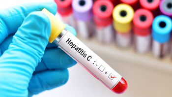 La Hepatitis C actúa de