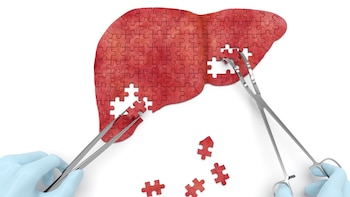 En la mayoría de los