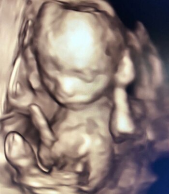 Ecografía 3D del hijo de