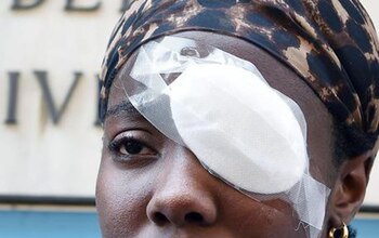 La italiana debió ser operada tras la agresión