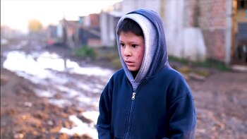 Alan tiene la enfermedad de