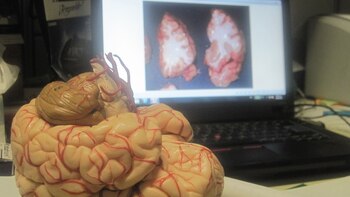 El doctor Lopera logró crear