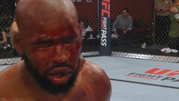 Así quedó el rostro de