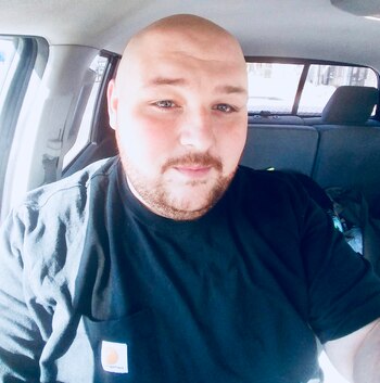 Tras perder una pierna en