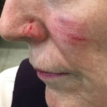 Luego de que una azafata