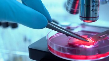 Mediante el diagnóstico precoz se