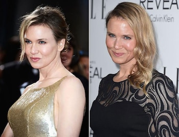 El antes y después de