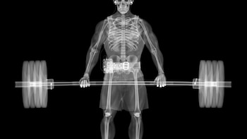 Nick Veasey/Getty Images