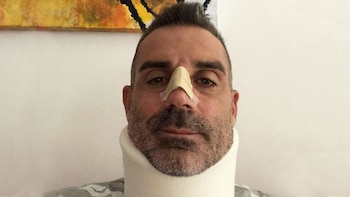 Así quedó el arquero tras