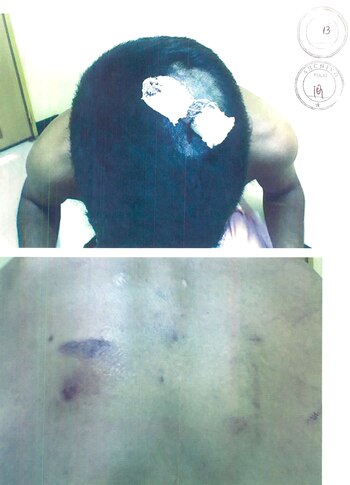 Las lesiones que sufrió Mendoza