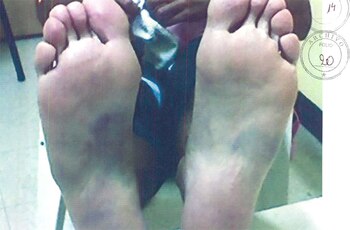 Las plantas de los los