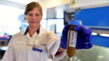 Además de desórdenes intestinales, las