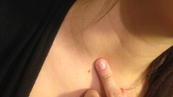 Así lucía el pequeño bulto