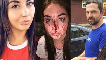 Louise Reed, antes y después.