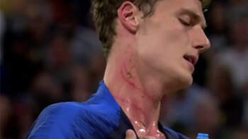 Así quedó el cuello de