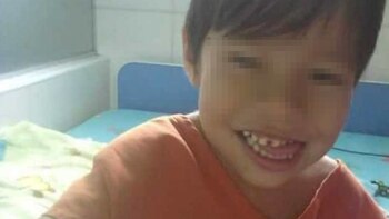 Sebastián, el niño boliviano sometido a la operación