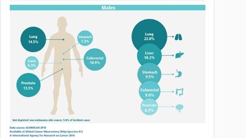 Cáncer en hombres a nivel