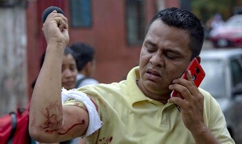 El periodista Winston Potosme herido