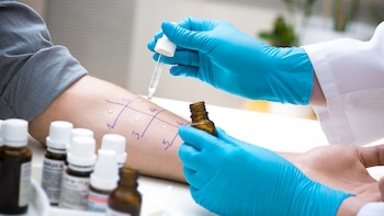 Una vez establecido el alérgeno,