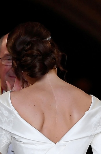 La impactante cicatriz de la