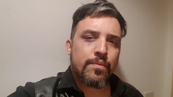 Albornos tiene 35 años y