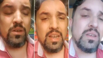 Fernando Albornos fue salvajemente golpeado