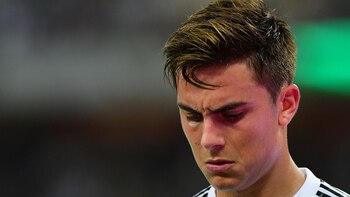 Paulo Dybala no tiene un