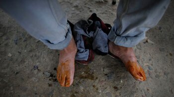 Orlando, de 44 años, acaba