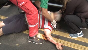 Así quedó la víctima luego