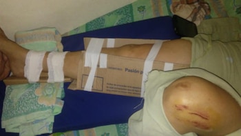 La pierna de la mujer, con cintas y pedazos de cartón (Daniel Ruiz)