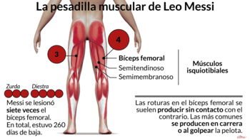 Infografía de Rodrigo Acevedo Musto