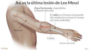 Infografía de Rodrigo Acevedo Musto