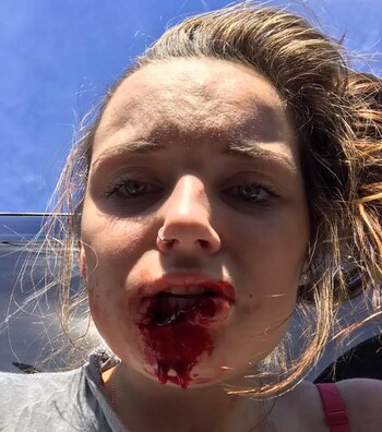 Kayla Hayes instantes después del