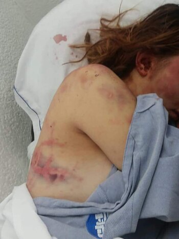 Maestro Karateca asestó una brutal