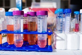 Los expertos aseguran que es