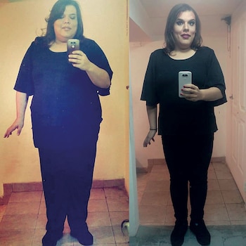 Empezó el tratamiento para hacerce