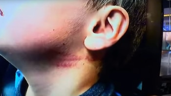 El niño presentaba moretones en cuello y cara (Foto: Especial Telemundo)
