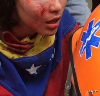 Una joven resultó heridas tras