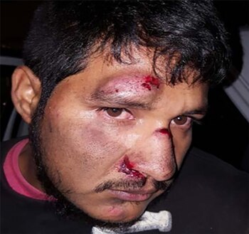 Policías golpearon brutalmente a un