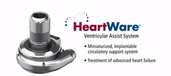Dispositivo de asistencia ventricular (VAD)
