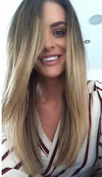 Rachael tuvo que ser intervenida