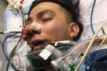 Luis Lopez fue sometido a