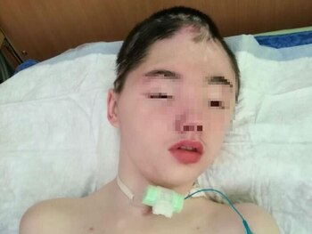 Vanya Krapivin tras el accidente