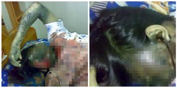 En redes sociales han circulado diversos casos donde han alertado los peligros de dormir cerca del celular
