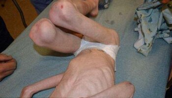 El niño se vio obligado