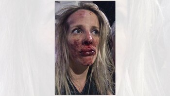 De Magistra tras el ataque.